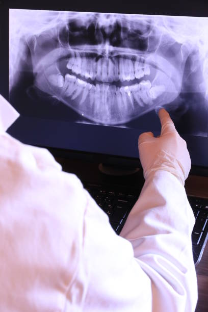 Best Emergency Denture Repair in Union City, MI
