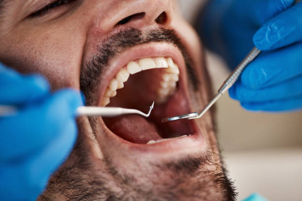Best Urgent Dental Care for Toothaches in Union City, MI